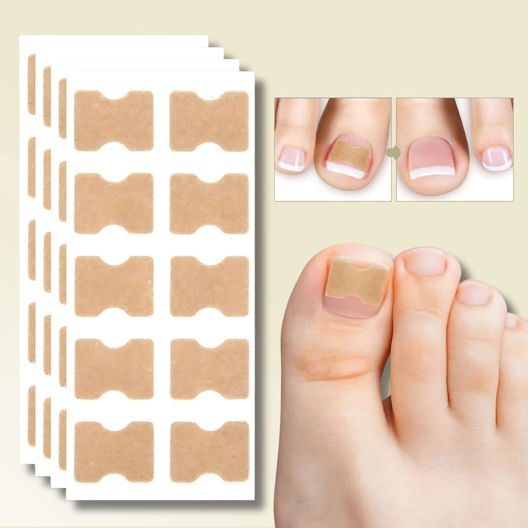 Ingrown Toenail Patches with Adhesive Backing for Nail Straightening 20 Count