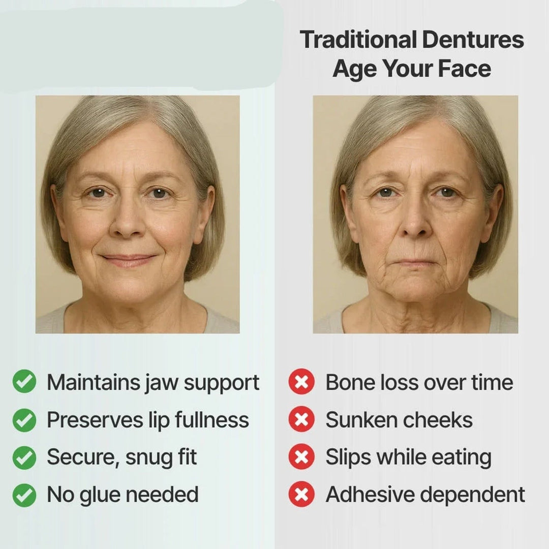 Removable full-arch denture set with flexible cushioned grip for daily use